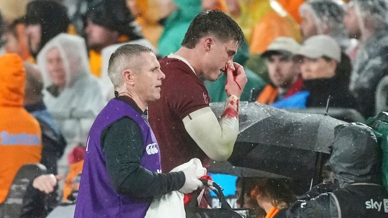 Tommy Freeman was forced off due to a failed HIA, as the Lions' 6-2 bench split came back to bite them