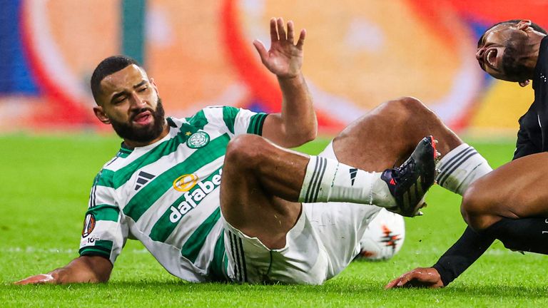 Cameron Carter-Vickers (L) del Celtic potrebbe restare fuori fino a marzo