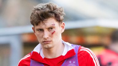 Jack MacKenzie was hit by the seat thrown by David Gowans