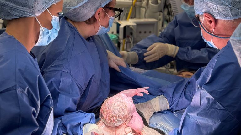 The moment Hugo Powell was born. Pic: Womb Transplant UK/PA

