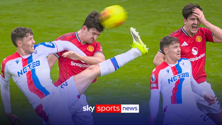 Harry Maguire injury claim goes viral 
