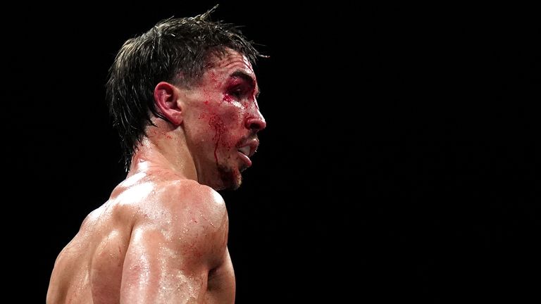 Michael Conlan's title ambitions have suffered a devastating blow.