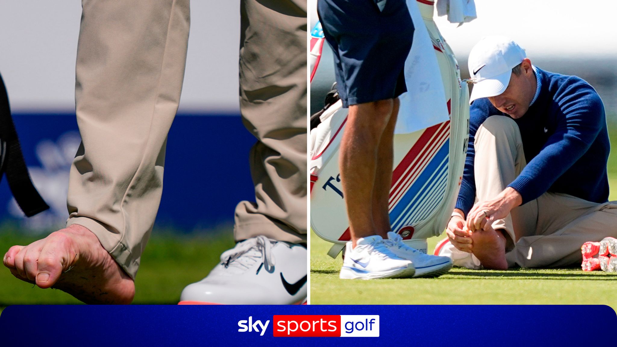 Explained: How toe blister has hampered McIlroy's major prep at PGA Champs