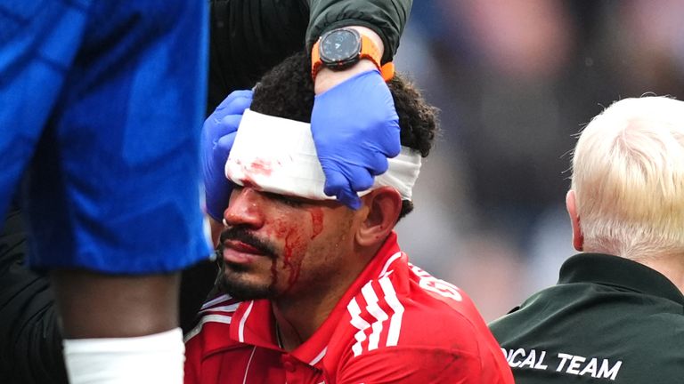 Nottingham Forest's Morgan Gibbs-White receives treatment for a head injury after a clash with Chelsea goalkeeper Robert Sanchez during the 