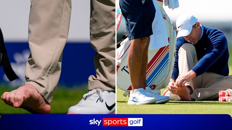 Rory McIlroy ends PGA Championship practice round early due to toe blister